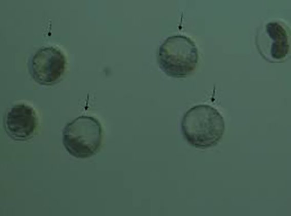 embriyo-transferi